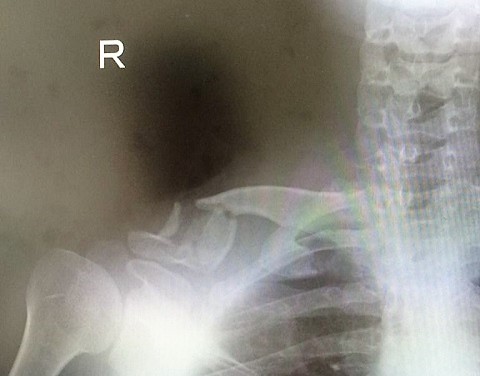 保険金、損害賠償金請求のツボ教えます！（イメージ画像）